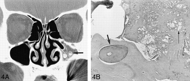 fig 4.