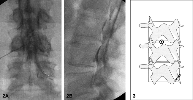 fig 2.