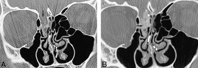 fig 3.