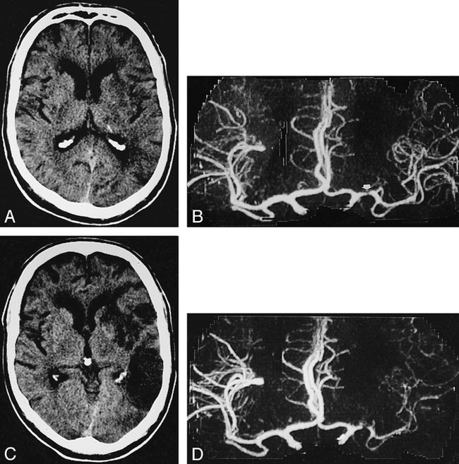 fig 7.