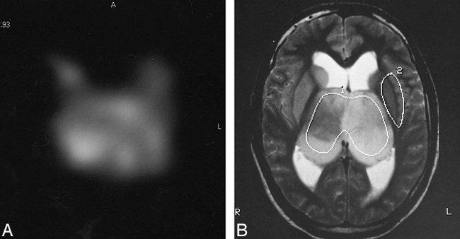 fig 3.