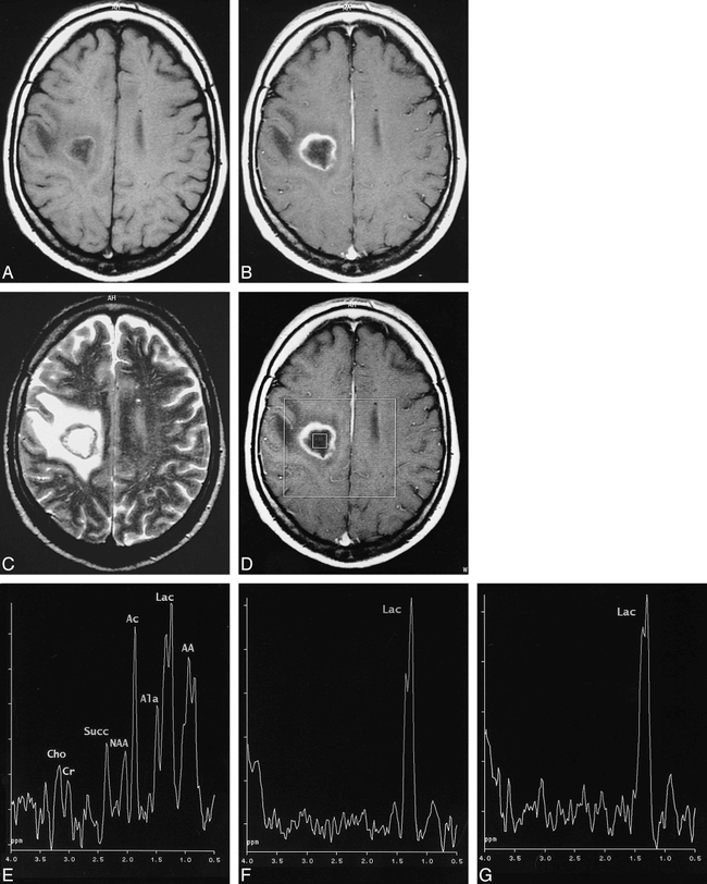 fig 3.