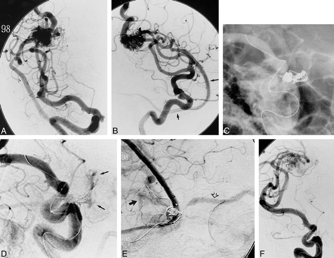 fig 1.