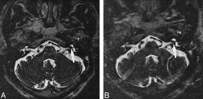 fig 6.