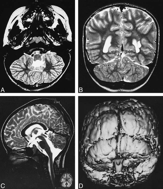 fig 1.