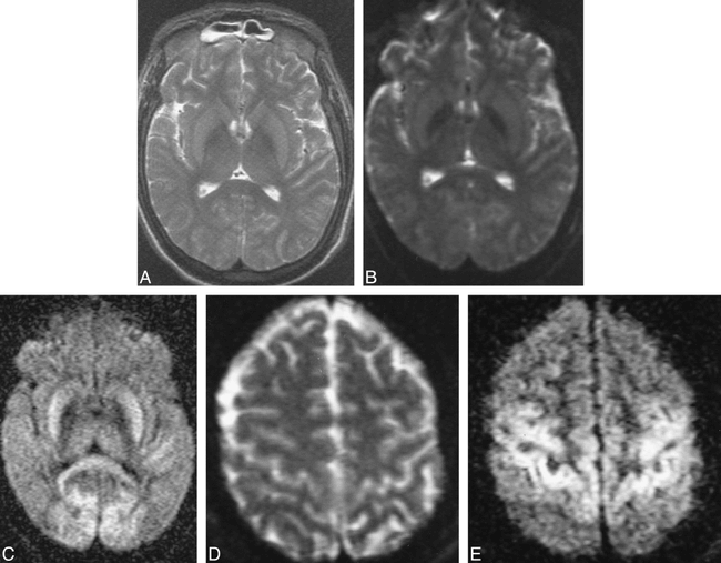 fig 3.