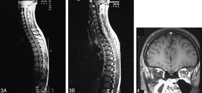 fig 3.