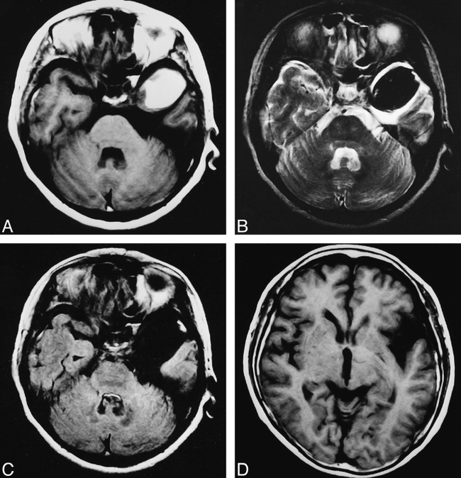 fig 3.