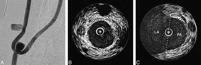 fig 5.