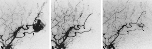 fig 1.