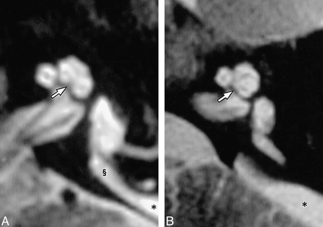 fig 3.