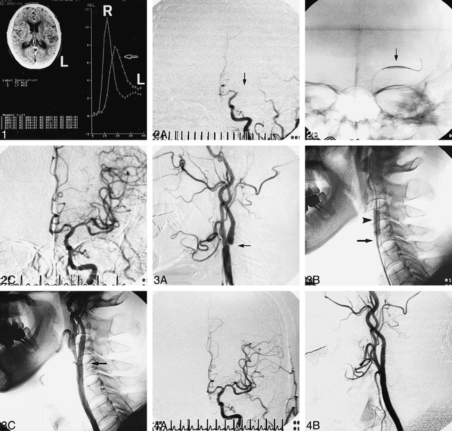 fig 1.