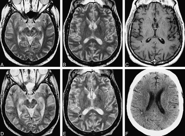 fig 3.