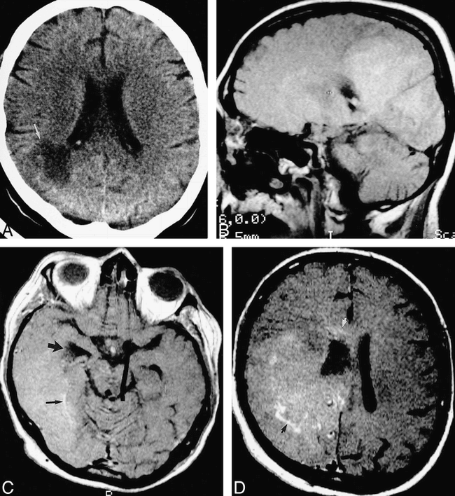 fig 5.