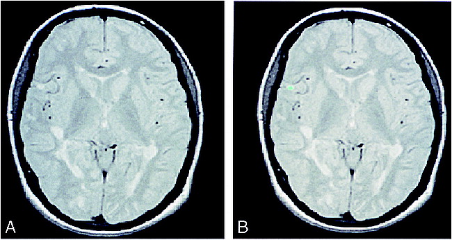 fig 3.