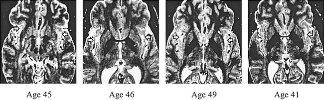 fig 3.