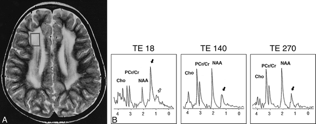 fig 2.