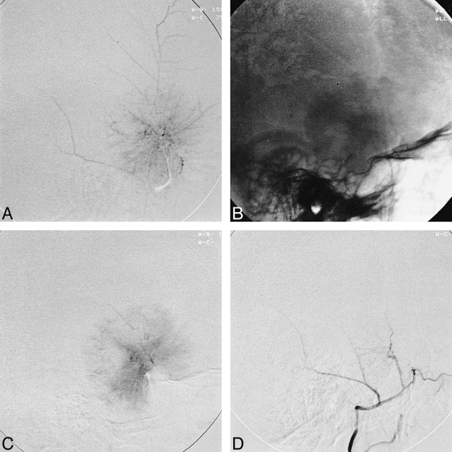 fig 2.