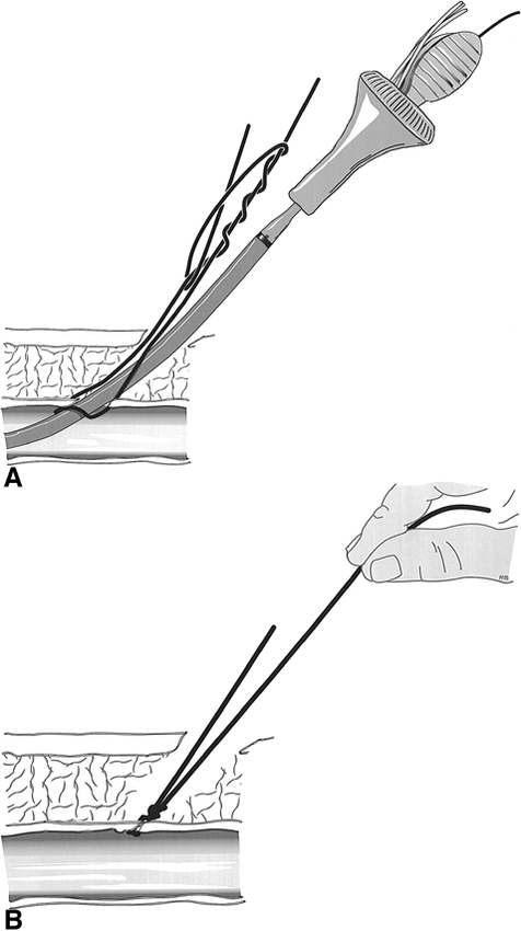 fig 5.