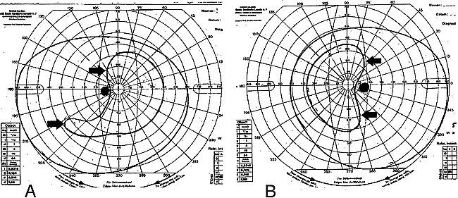 fig 2.