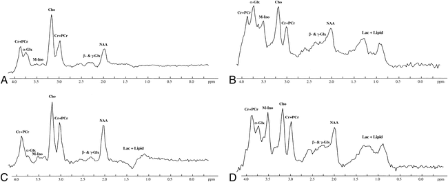 fig 4.