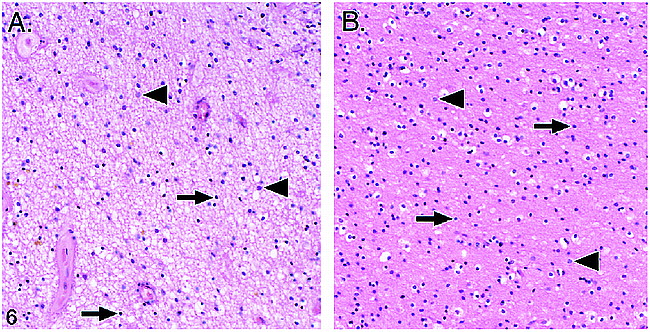 fig 6.