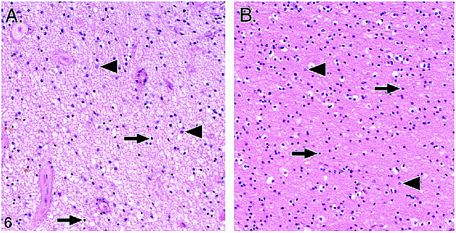 fig 6.