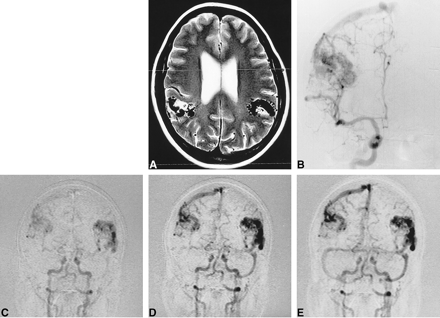 fig 1.