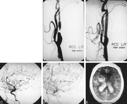 fig 3.