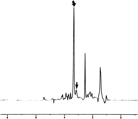 fig 2.