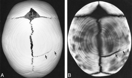 fig 5.