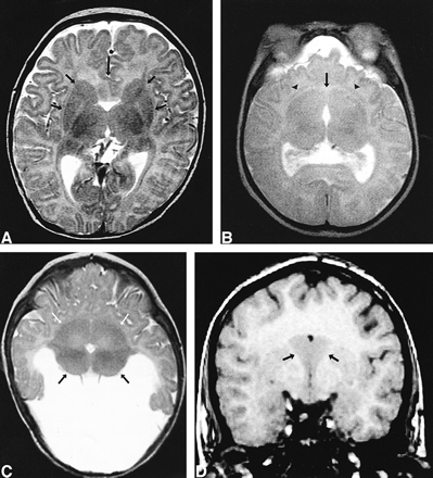 fig 1.