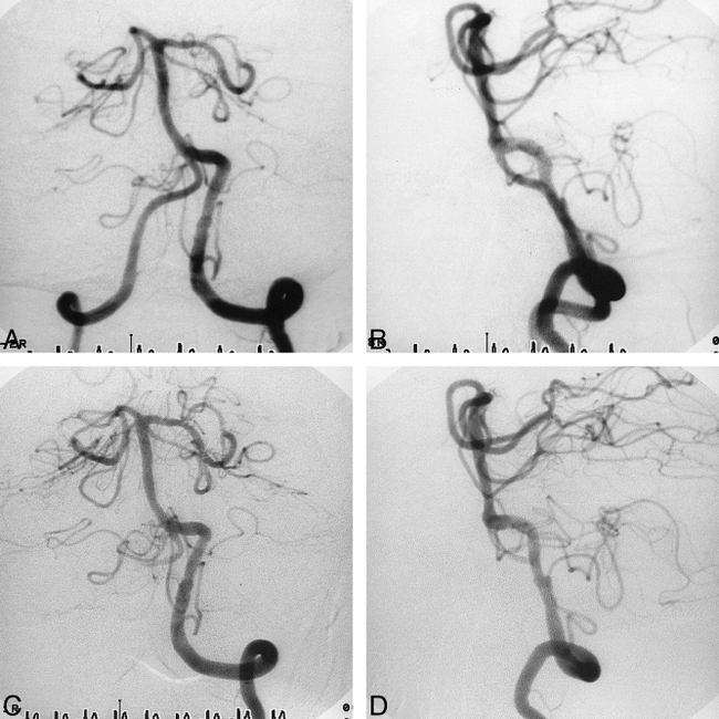 fig 2.