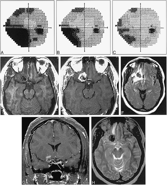 fig 1.