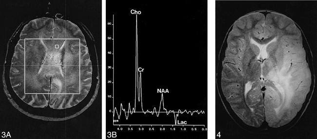 fig 3.