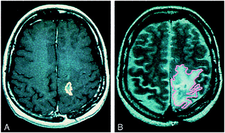 fig 3.