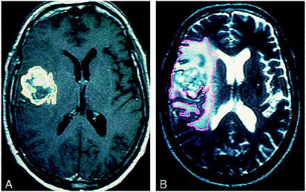 fig 4.