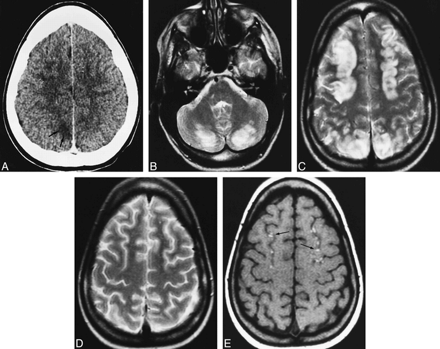 fig 3.