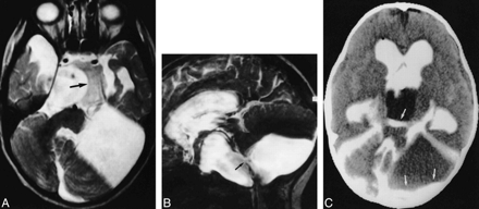 fig 6.