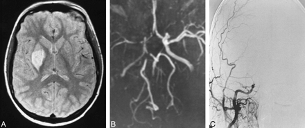 fig 2.