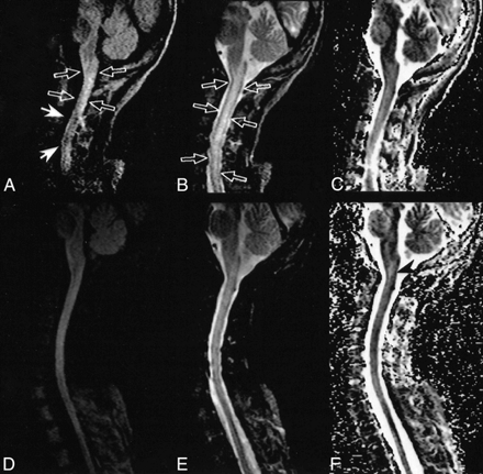 fig 3.