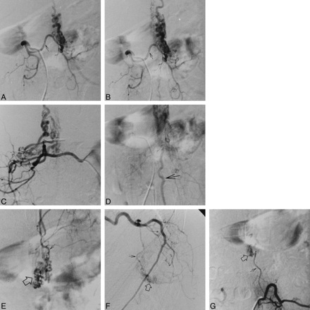 fig 3.