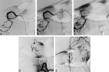 fig 4.