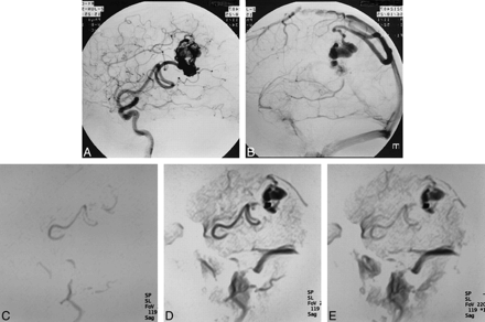 fig 3.