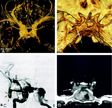 fig 1.