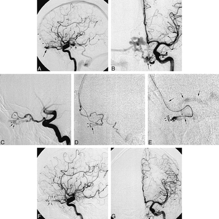 fig 2.