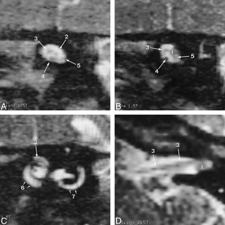 FIG 3.