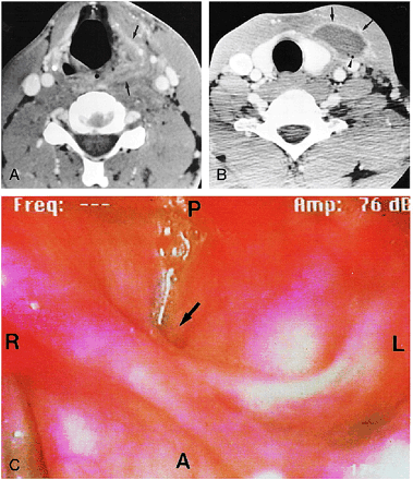 FIG 3.