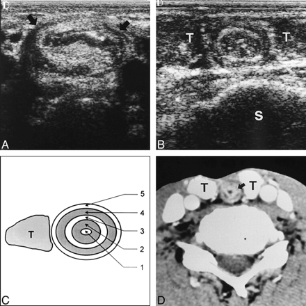 FIG 1.