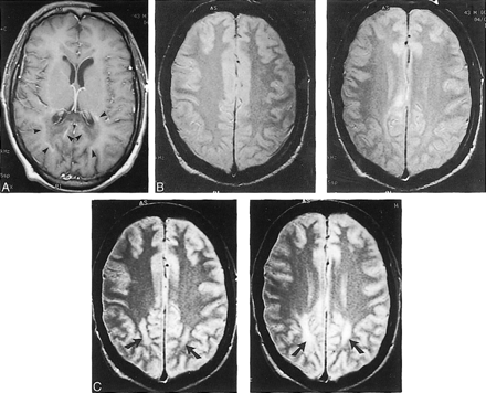 FIG 2.